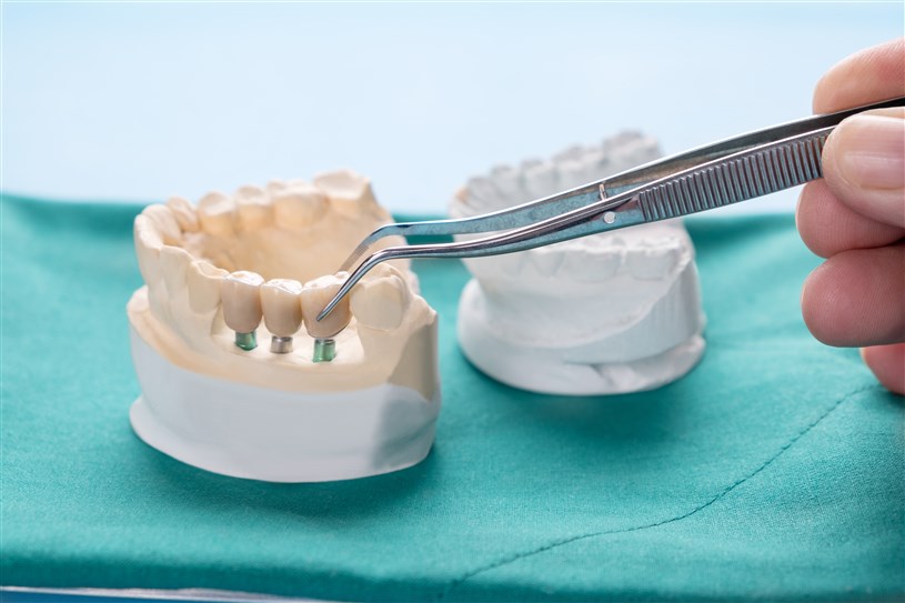 What are the treatments offered by our prosthodontists?